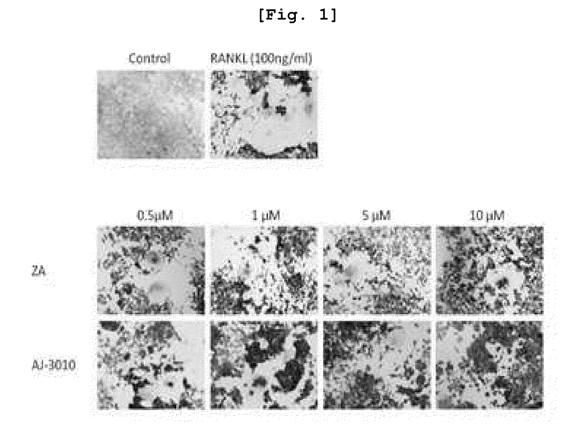New compounds for inhibiting differentiation of osteoclast and pharmaceutical composition comprising thereof