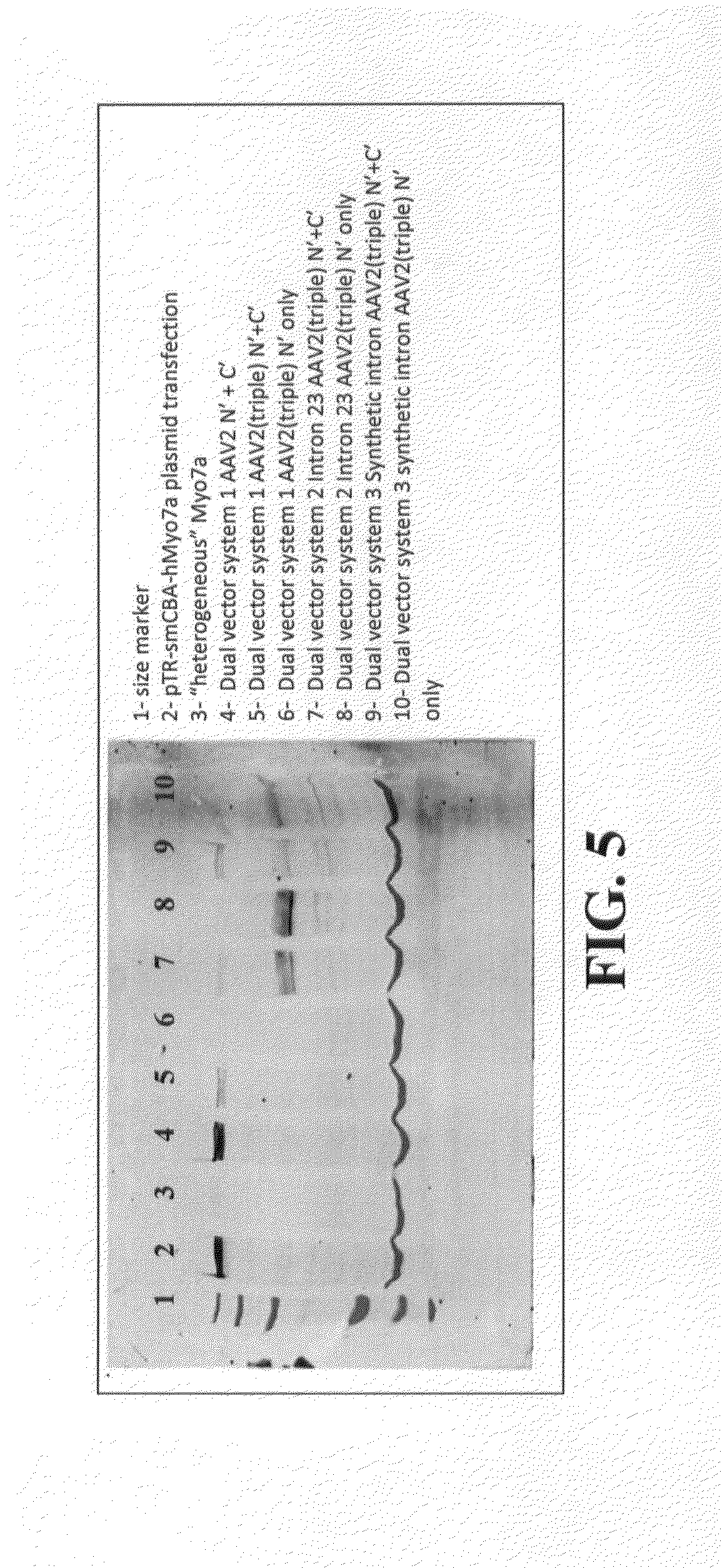Dual-AAV Vector-Based Systems and Methods for Delivering Oversized Genes to Mammalian Cells
