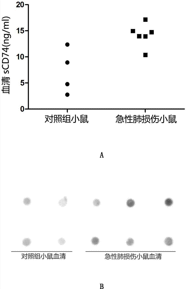 ELISA detection kit for mice-derived soluble CD74 proteins and detection method of ELISA detection kit