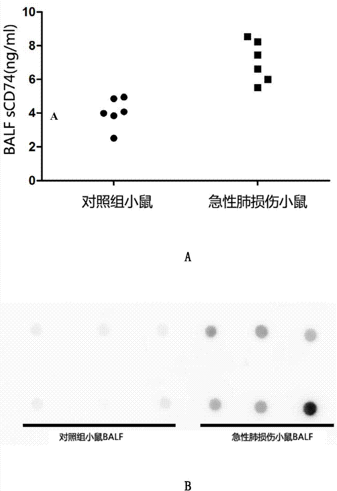 ELISA detection kit for mice-derived soluble CD74 proteins and detection method of ELISA detection kit