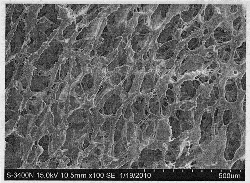 Method for preparing cross-linked carboxymethyl chitin tissue ...