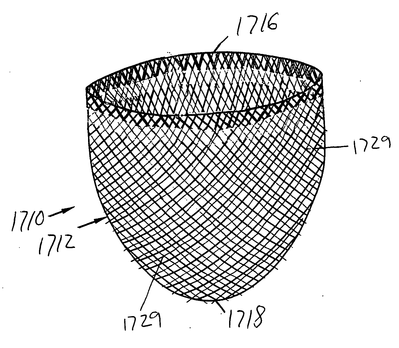 Self-adjusting securing structure for a cardiac support device