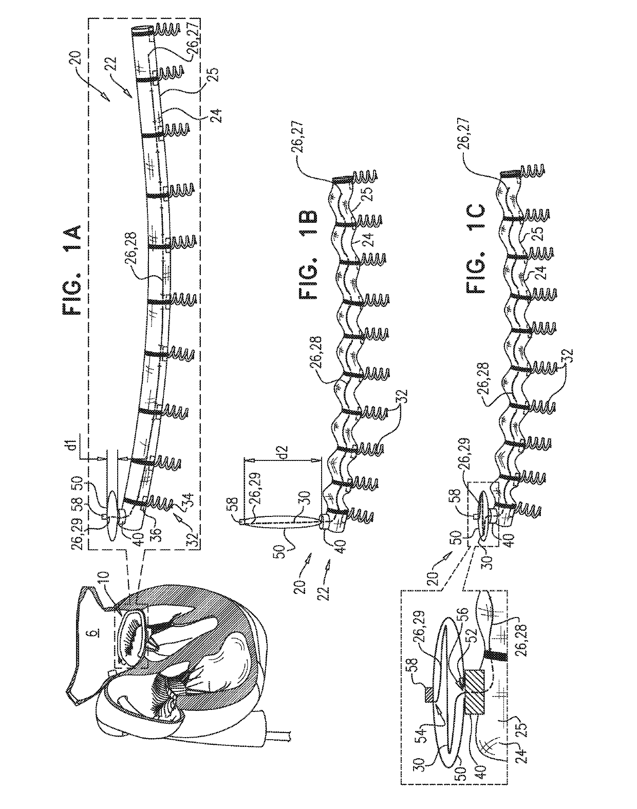 Implant-cinching devices and systems