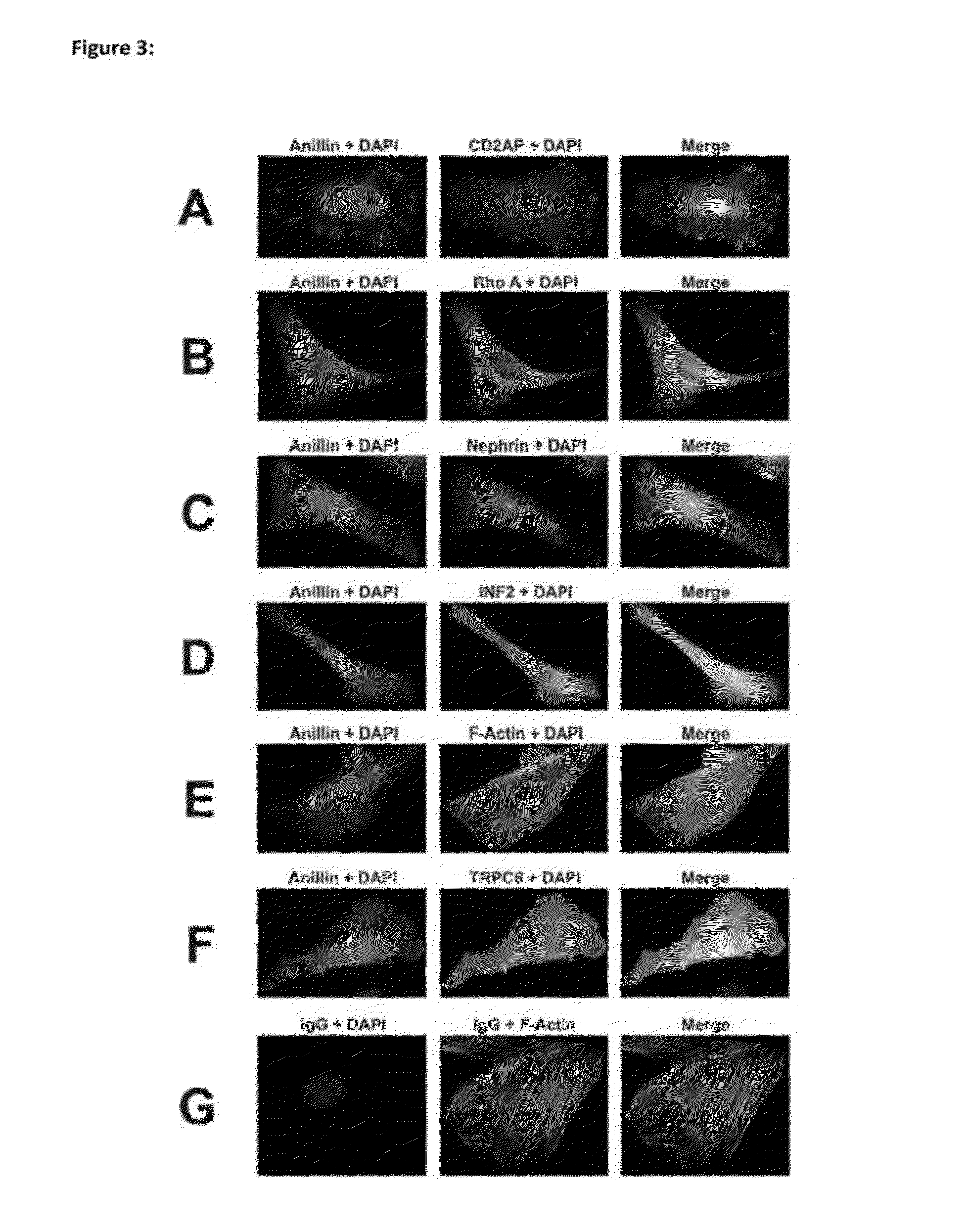 Novel genes causing hereditary kidney disease or malformation of the urinary tract