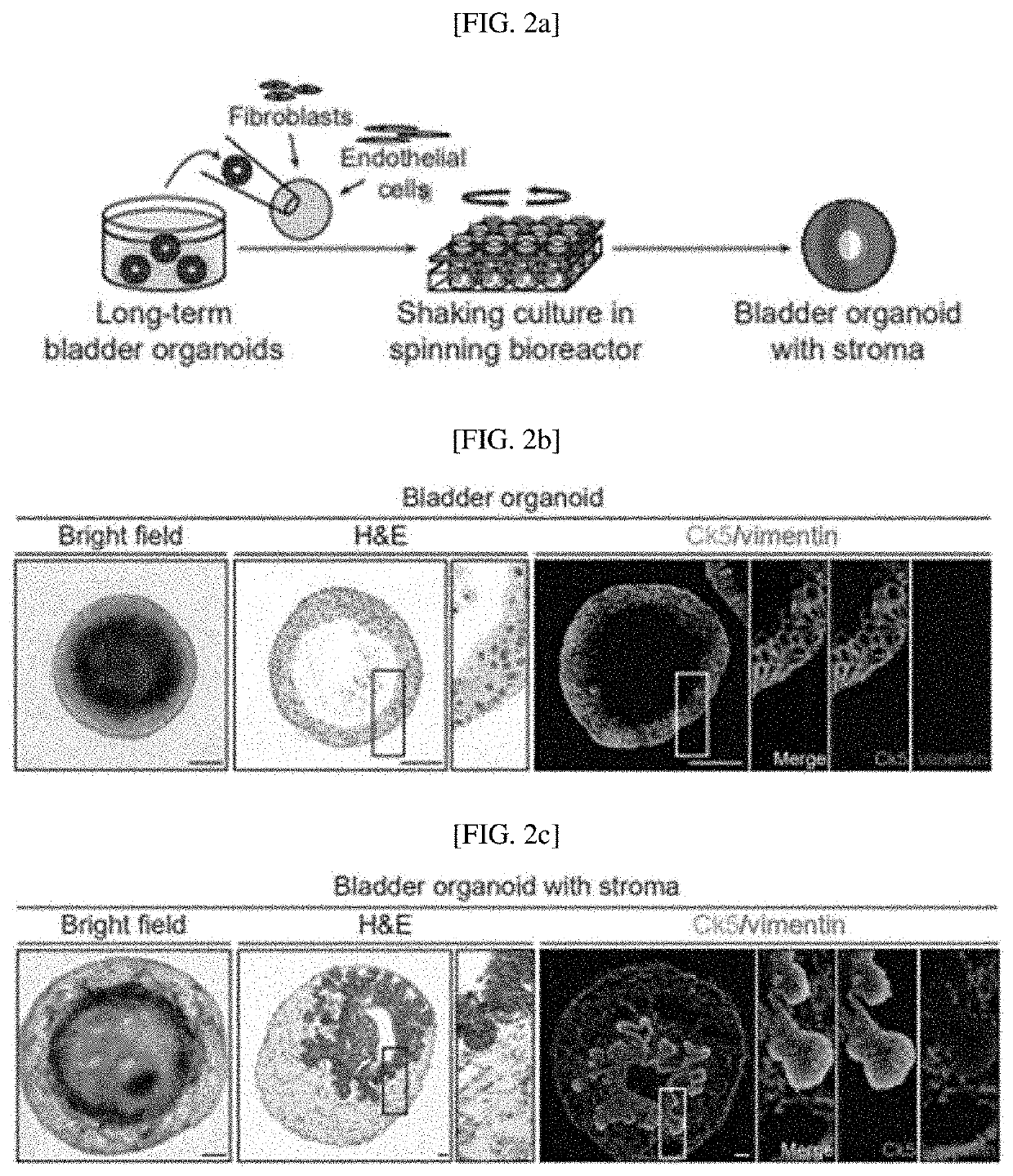Assembloid - 3D mimetic tissue structure based on patient- derived  multiple  cell  types  and  method  of  manufacturing the same