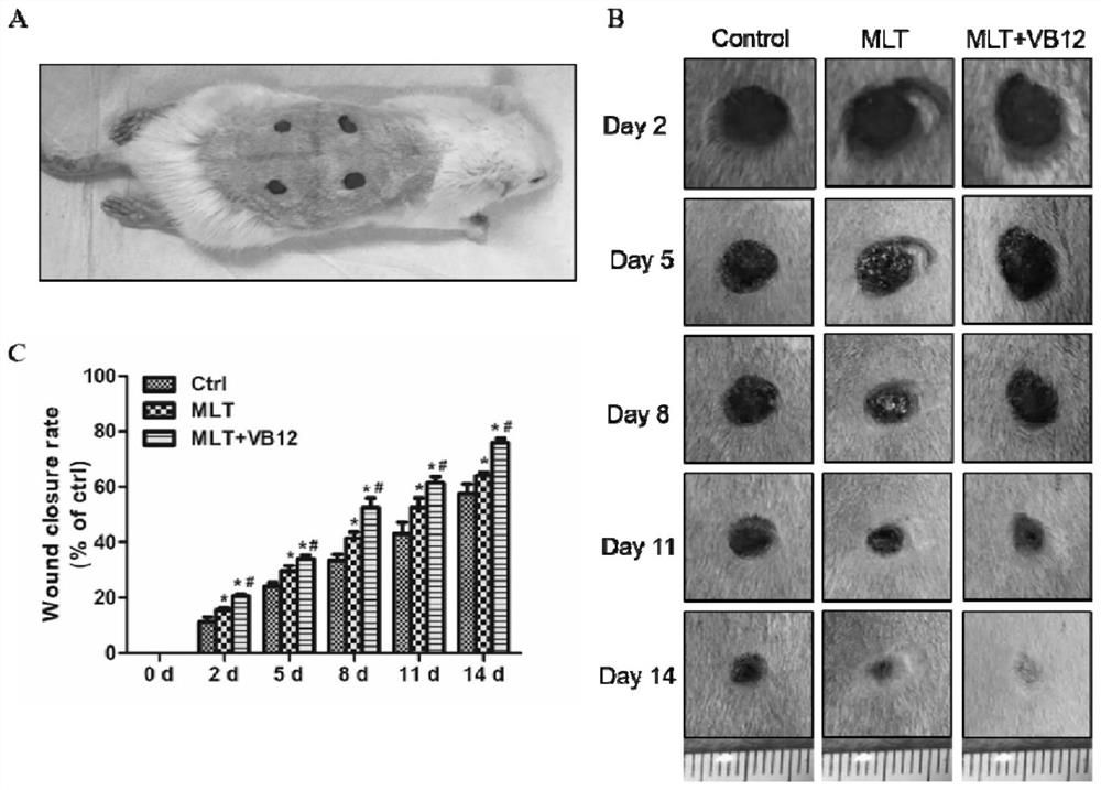 Application of melatonin combined with methylcobalamin in the treatment of diabetic wound healing disorder