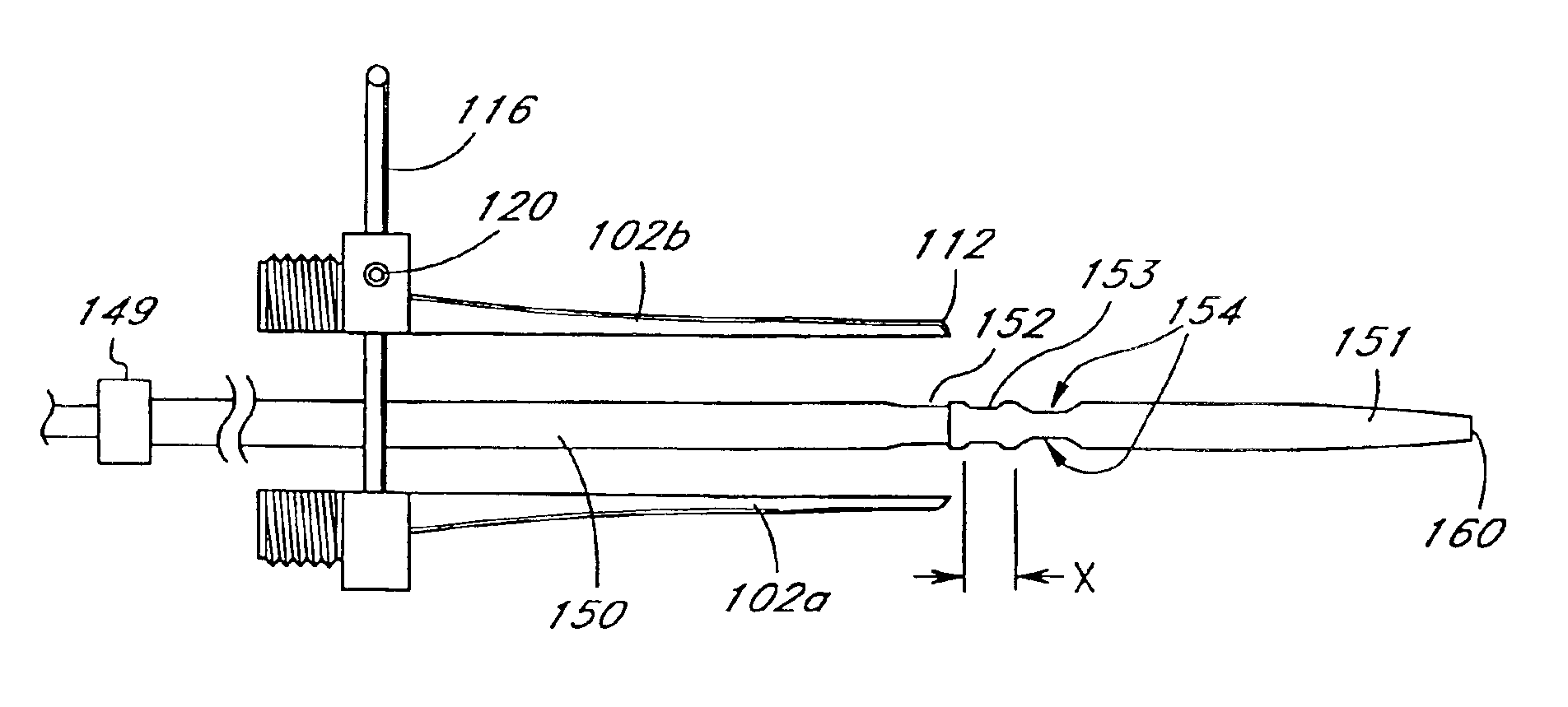Tissue opening locator and everter and method
