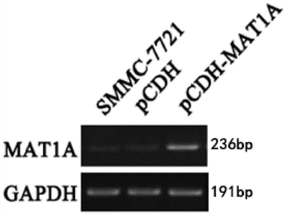 siRNA capable of inhibiting mat2a gene expression and its application