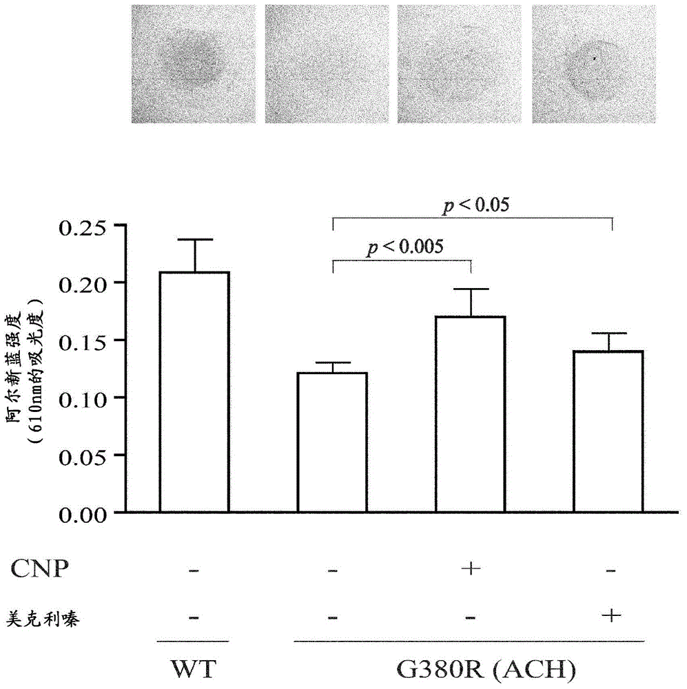 Therapeutic agent for systemic bone disease and use thereof