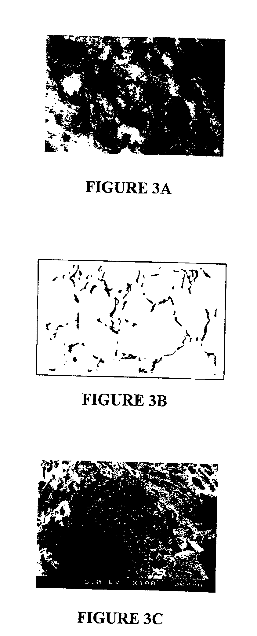 Macroporous polymer scaffold containing calcium phosphate particles