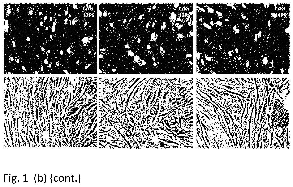 Therapeutic method for huntington's disease