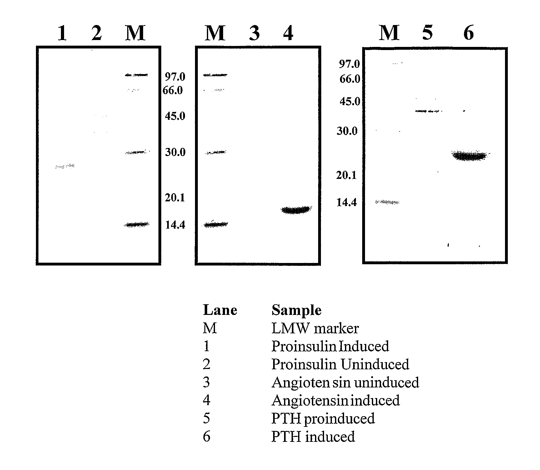 Process for the expression of peptides of interest using GCSF as a fusion partner