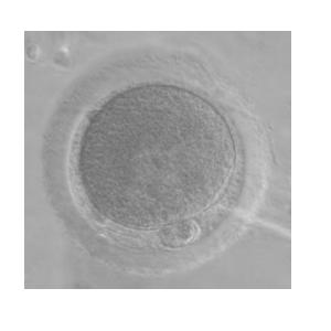 Method applicable to in-vitro mature culture of young rabbit oocytes and formulation of culture medium