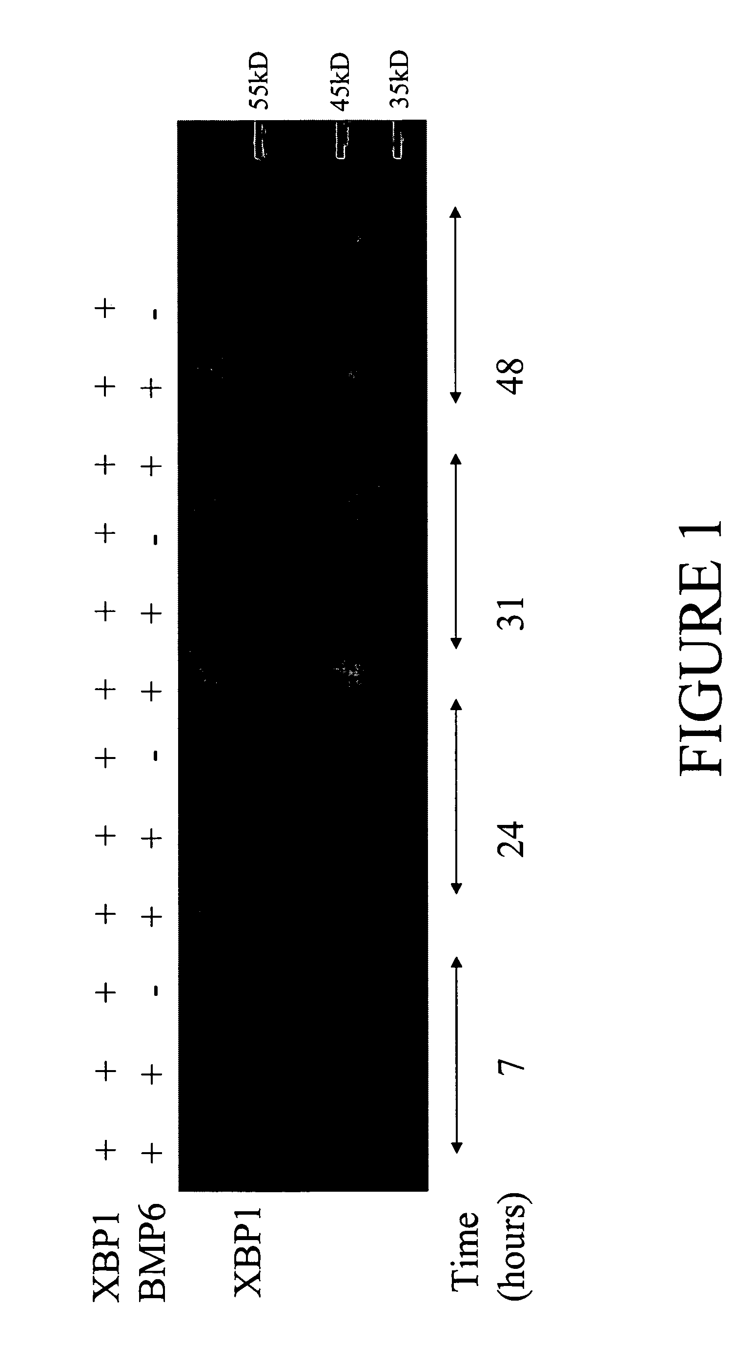 Systems and methods for protein production