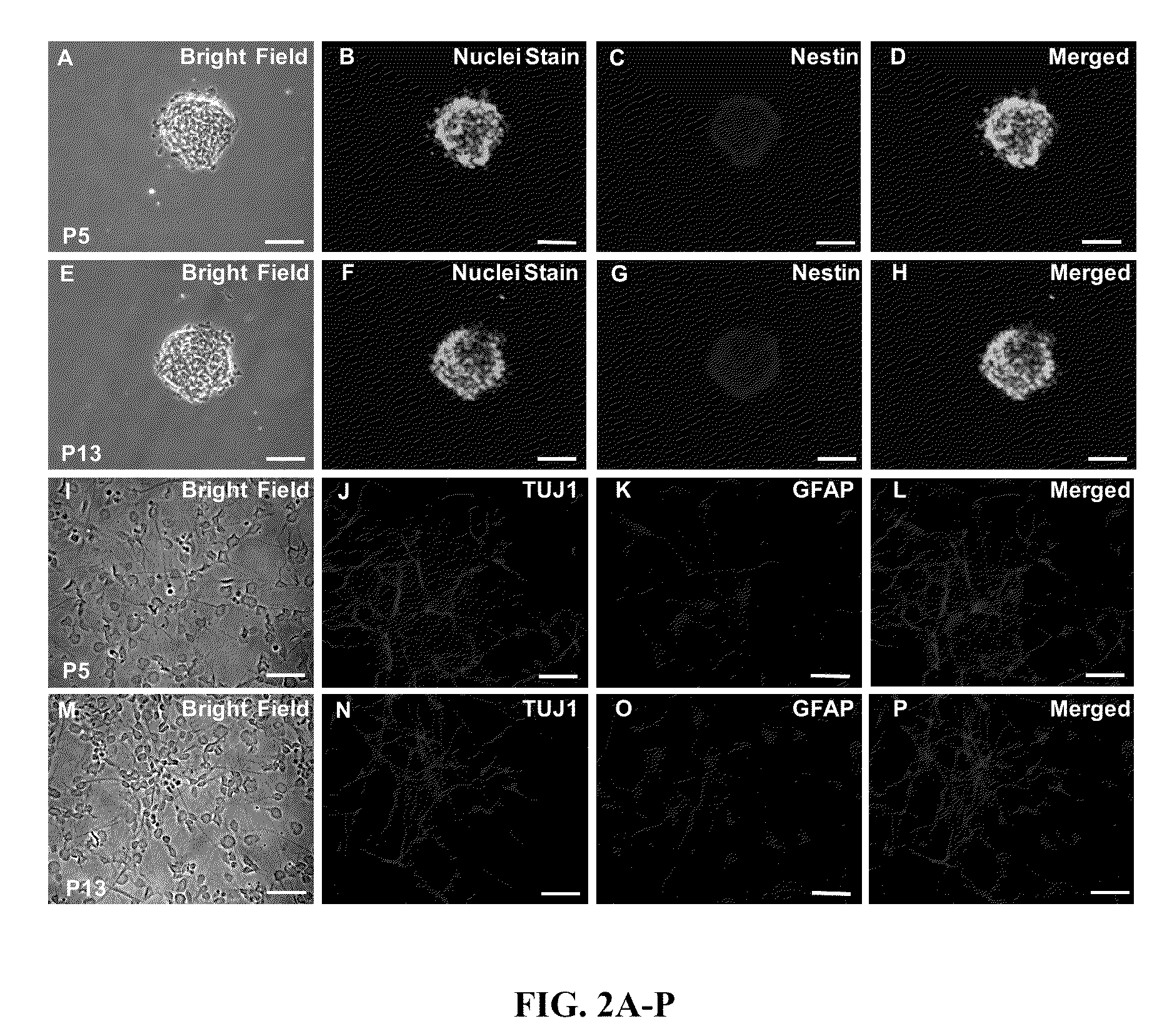 Methods and Compositions for Culturing of neural Precursor Cells