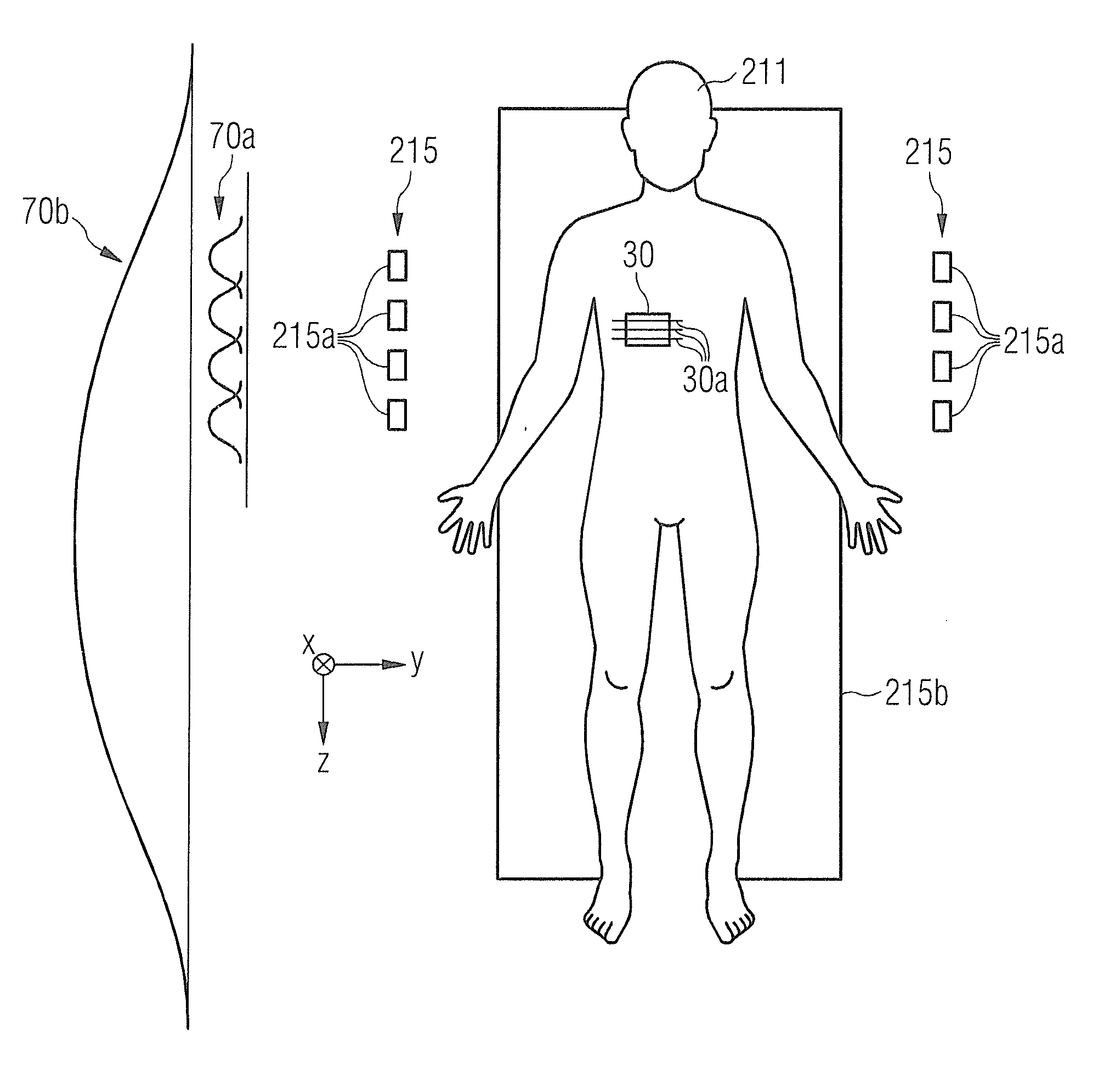Elastography method, and magnetic resonance system for implementing an elastography method