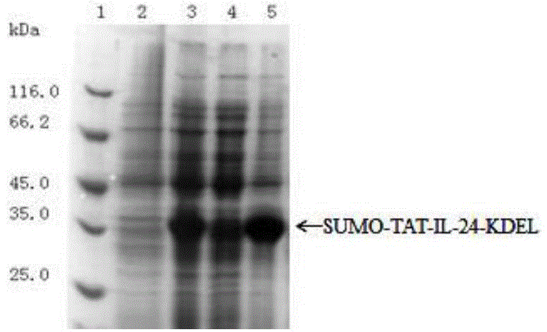 Tat-il-24-kdel fusion protein and its preparation method and application