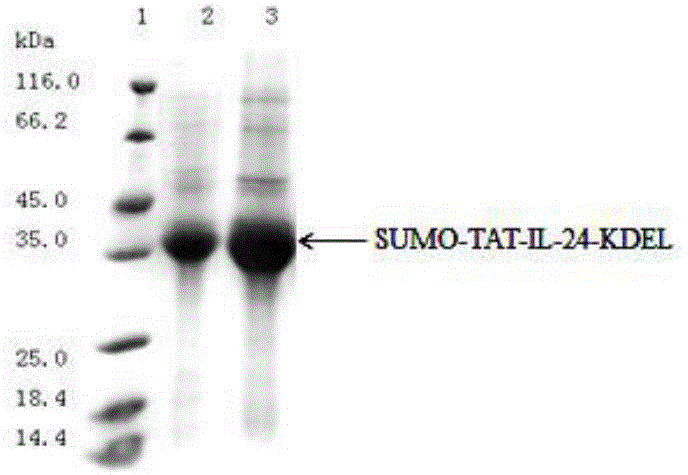 Tat-il-24-kdel fusion protein and its preparation method and application