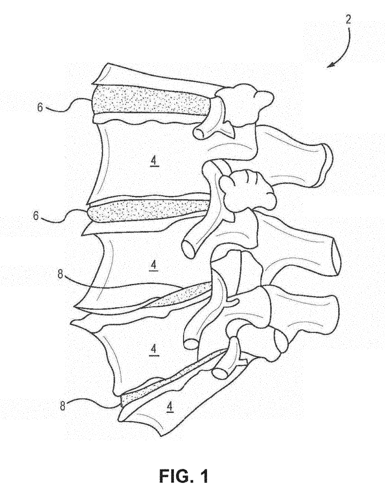 Acif cage, cage system and method