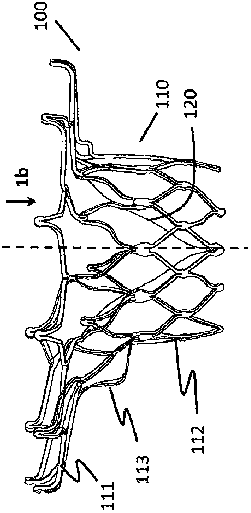 A heart valve prosthesis