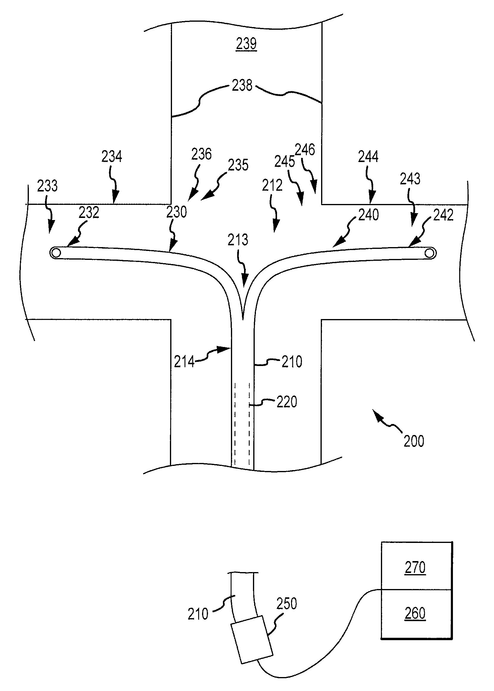 Acute kidney injury treatment systems and methods