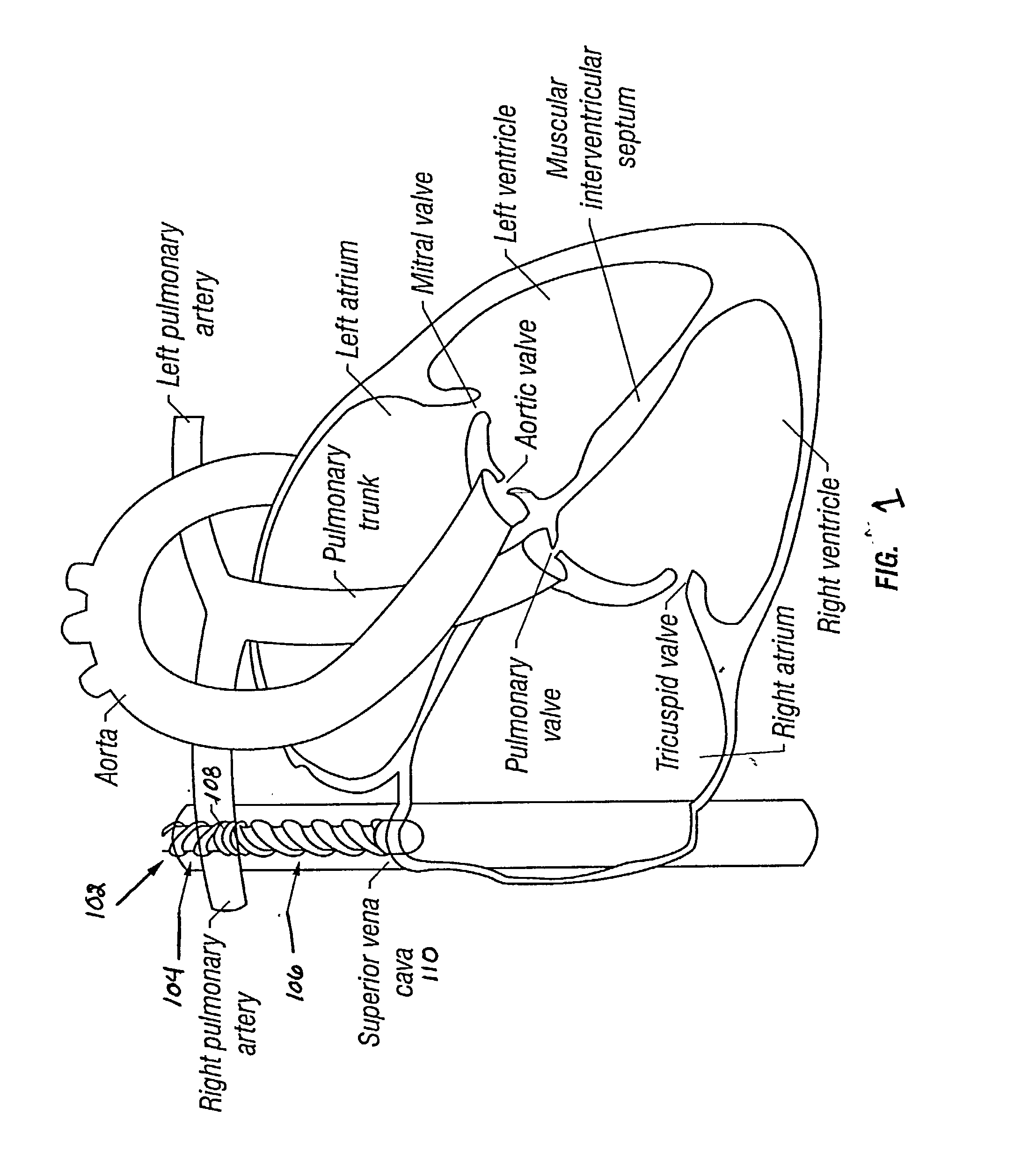 System and method for patient temperature control employing temperature projection algorithm