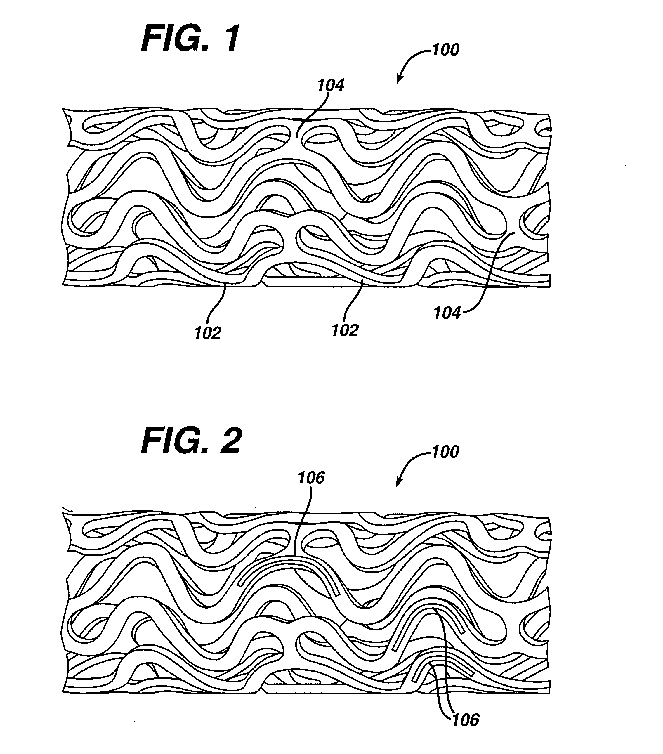Drug releasing anastomosis devices and methods for treating anastomotic sites
