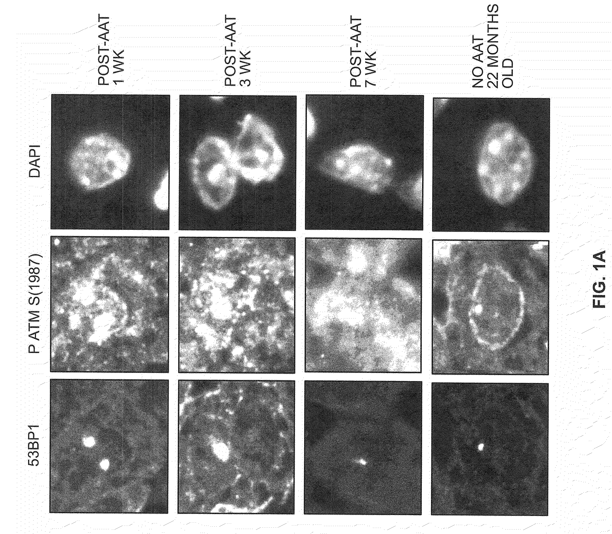 Methods for determining aged based accumulation of senescent cells using senescence specific DNA damage markers