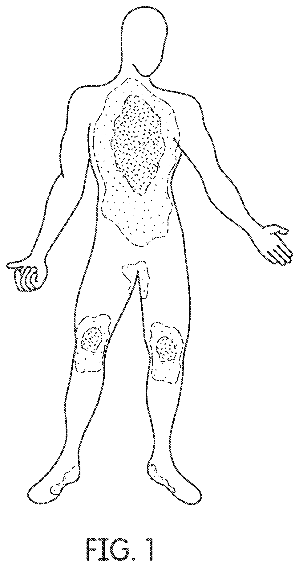 Wearable phototherapy apparatus