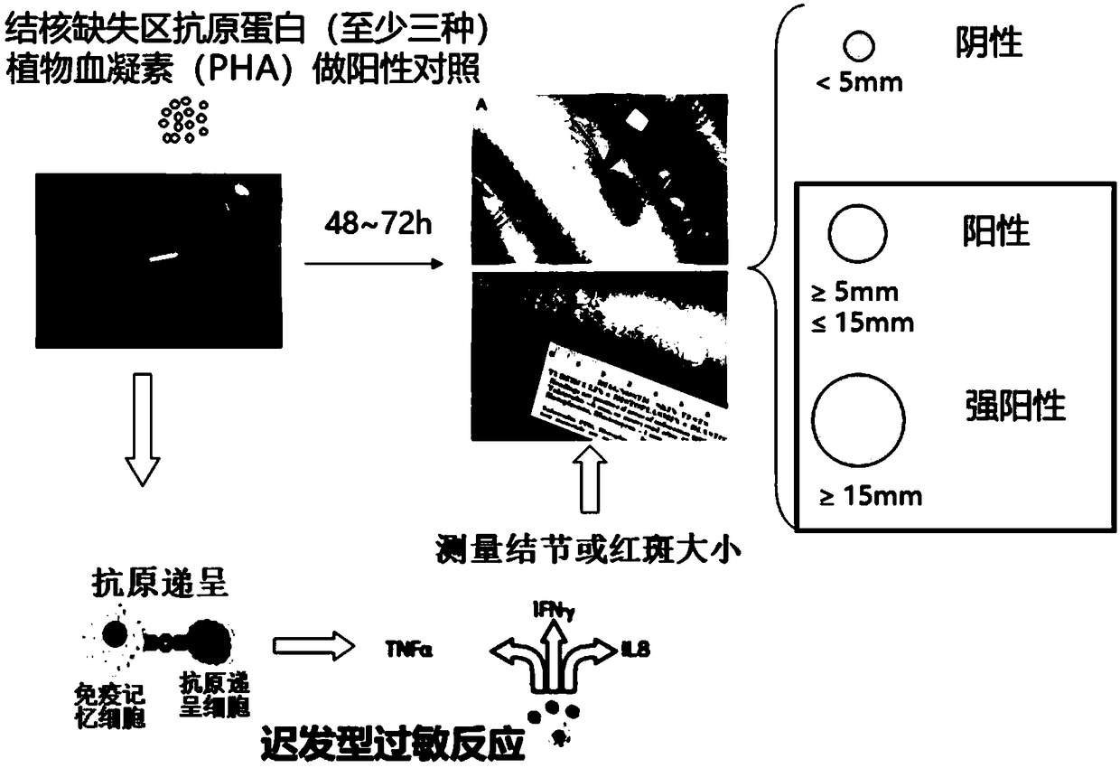 Tuberculous infection diagnostic kit, screening system and application of kit