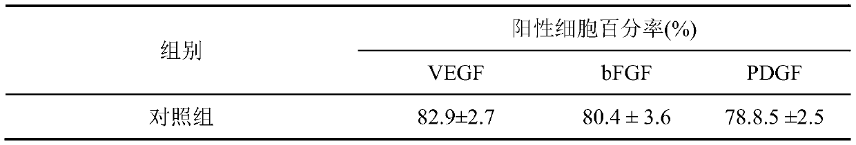 A red ray cartilage polypeptide angiogenesis inhibitory factor