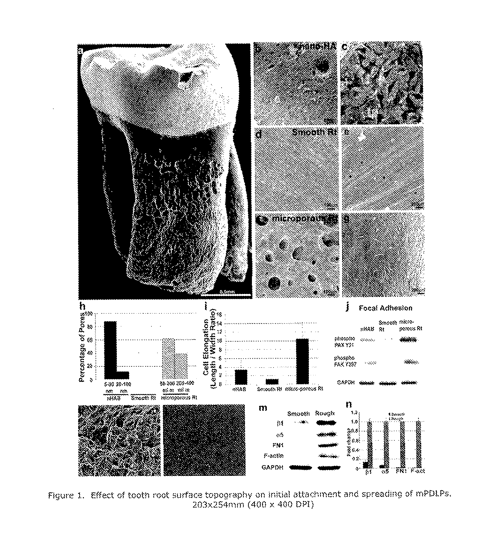 Reagents and methods for preparing teeth for implantation