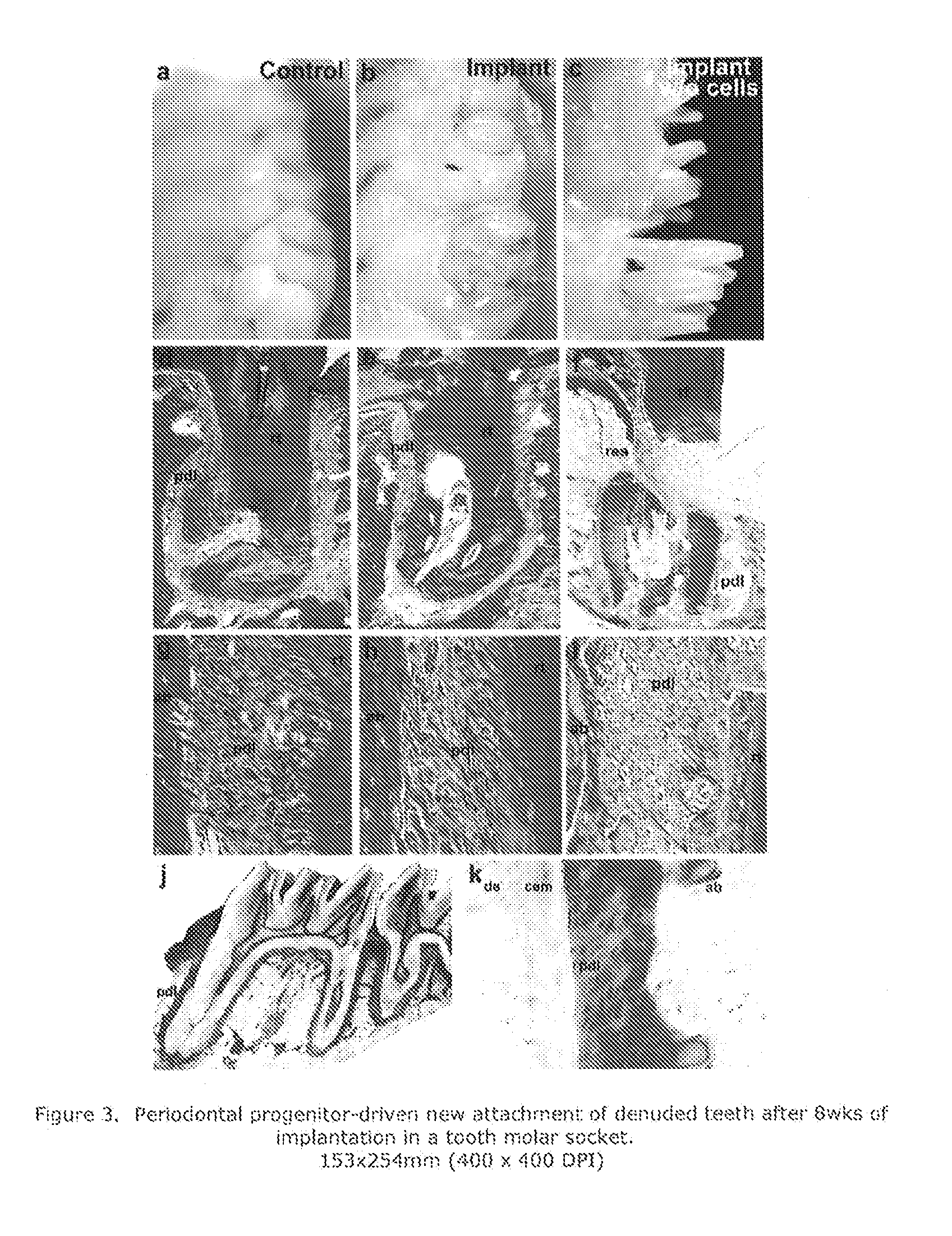Reagents and methods for preparing teeth for implantation