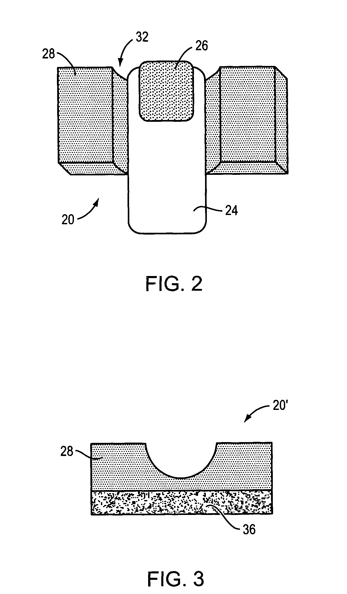 Method and apparatus for treating a diseased nail