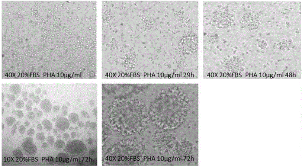 Immune toxicity evaluation method for new medicine development