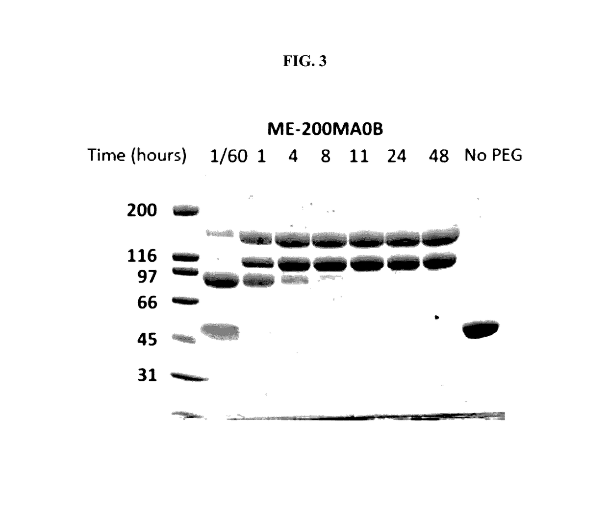 Compositions and methods for treatment of homocystinuria