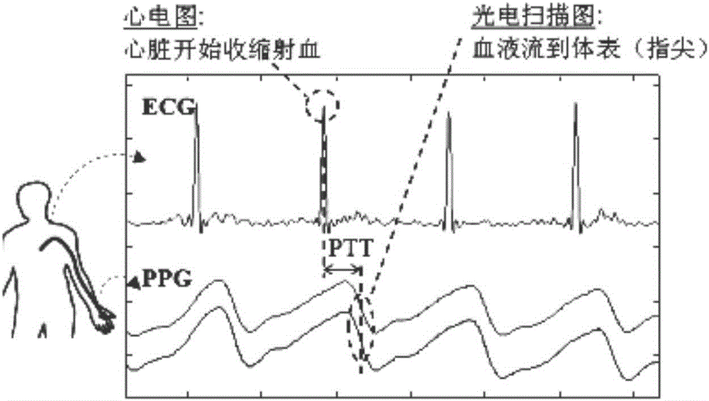 Human body electrocardiographic R wave detection system