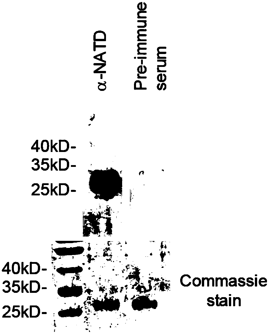 Marker related to auxiliary diagnosis of non-small cell lung cancer and application thereof