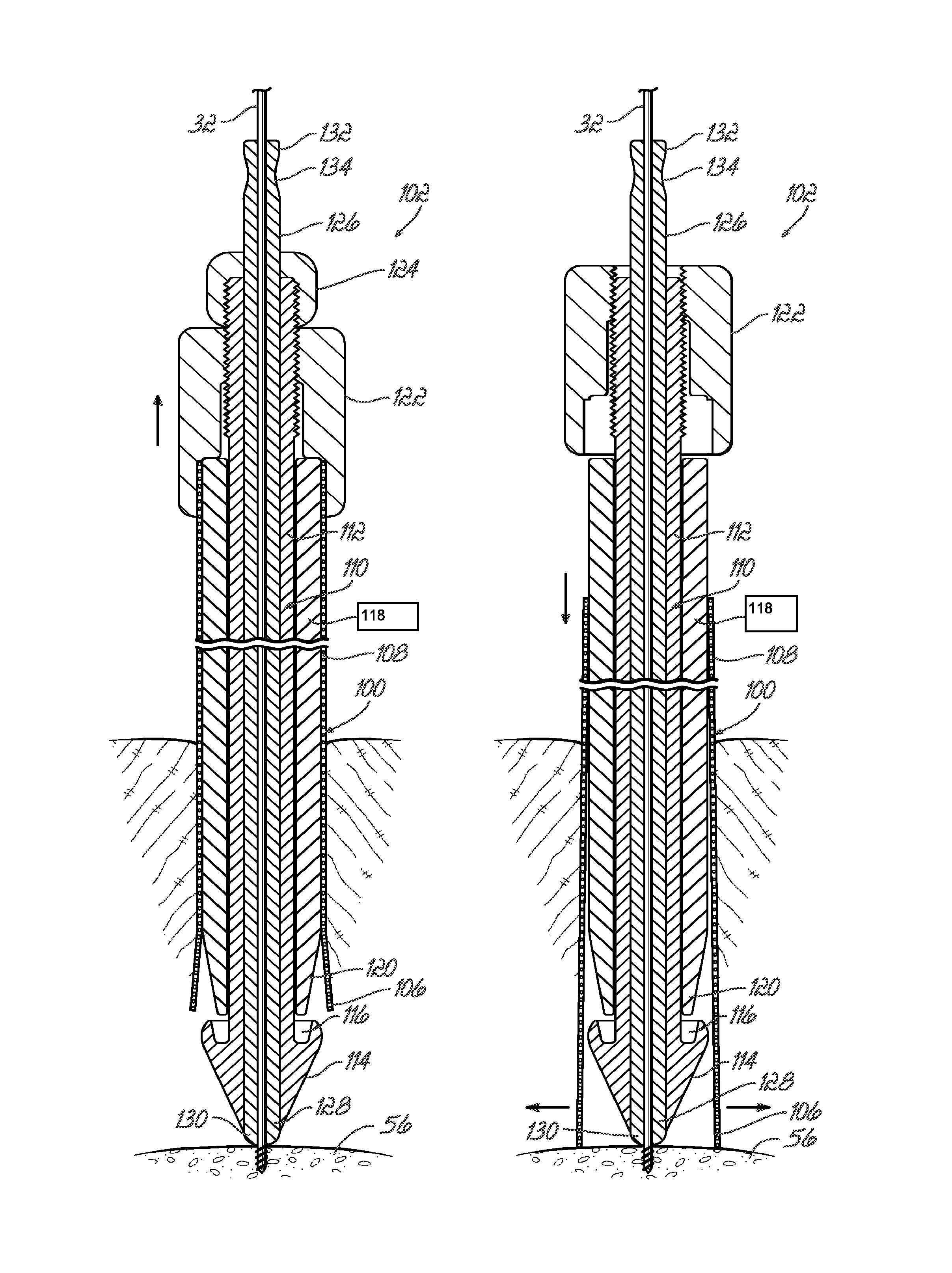 Surgical site access system and deployment device for same
