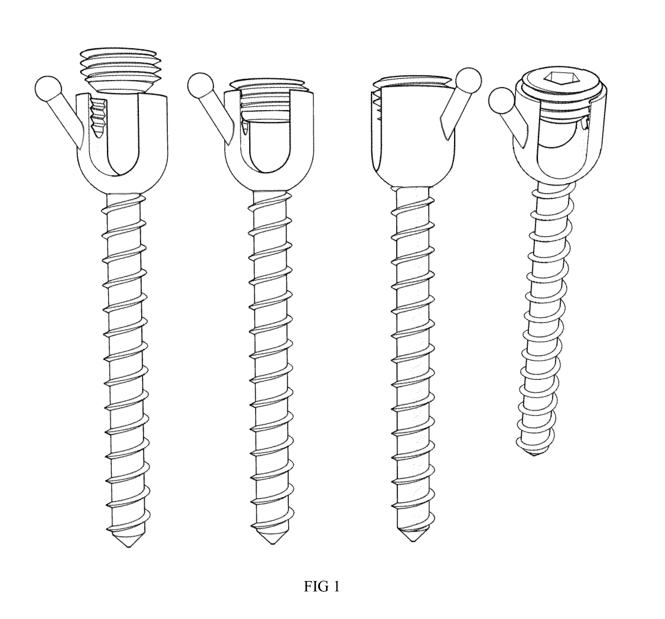 Method and System for the Treatment of Spinal Deformities