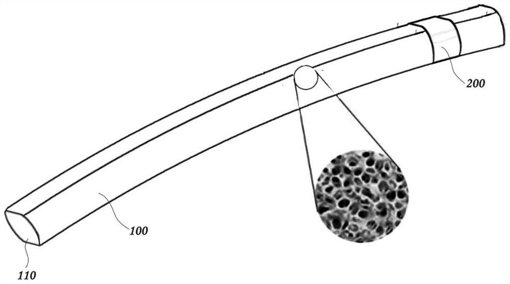 Drainage device suitable for glaucoma treatment