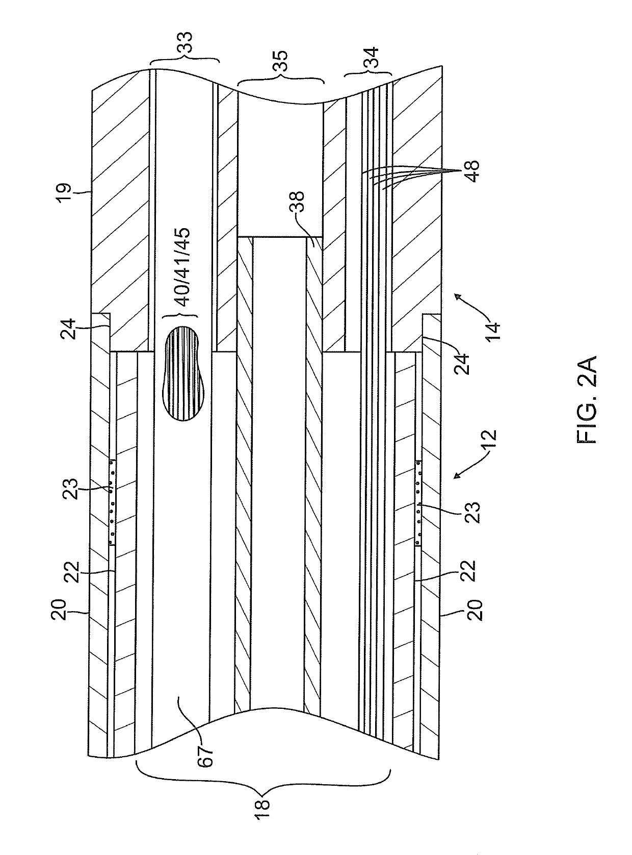 Catheter having a distal section with spring sections for biased deflection