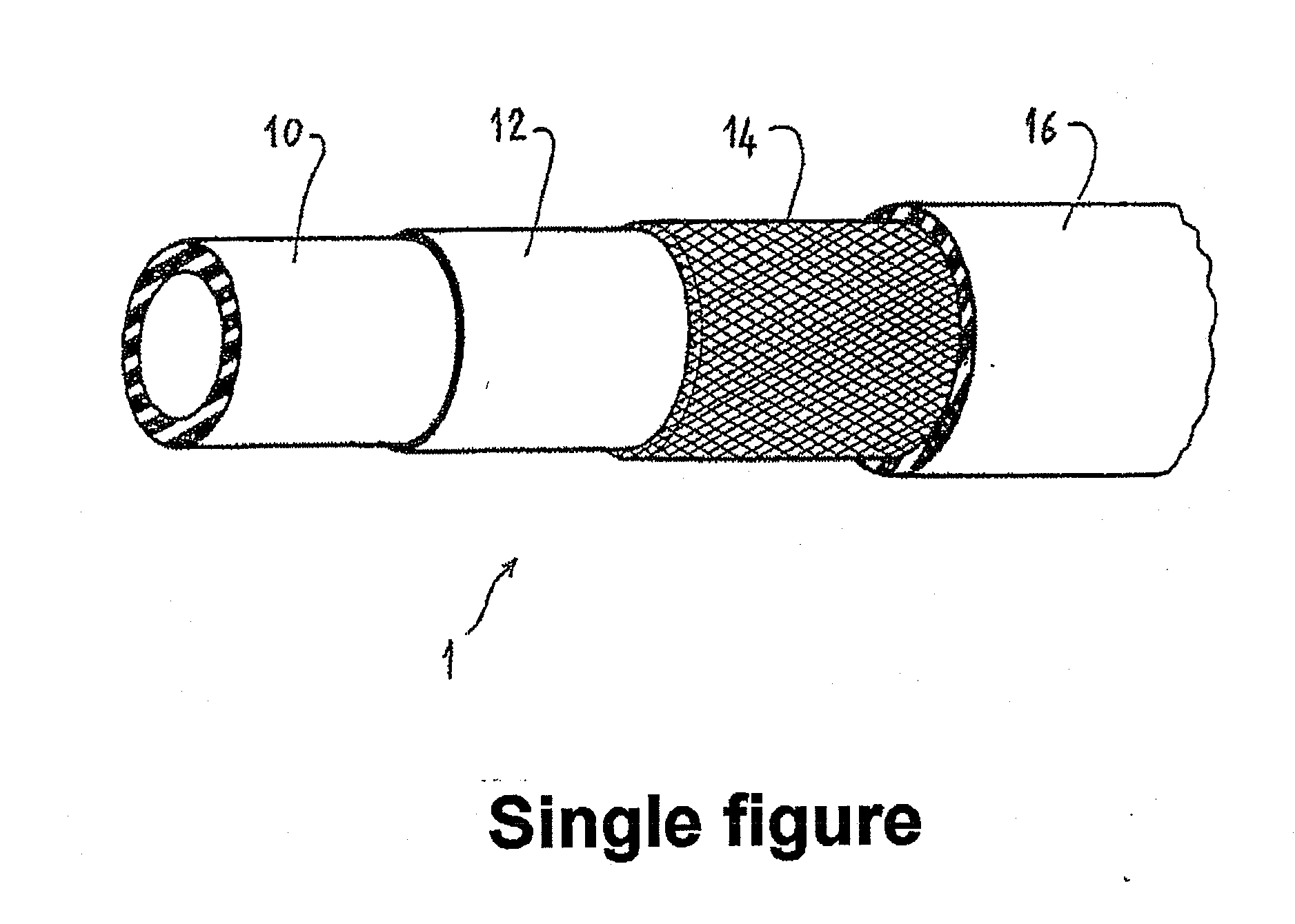 Pipe for the Air Intake Circuit of a Motor Vehicle Engine, and Circuit Incorporating the Same