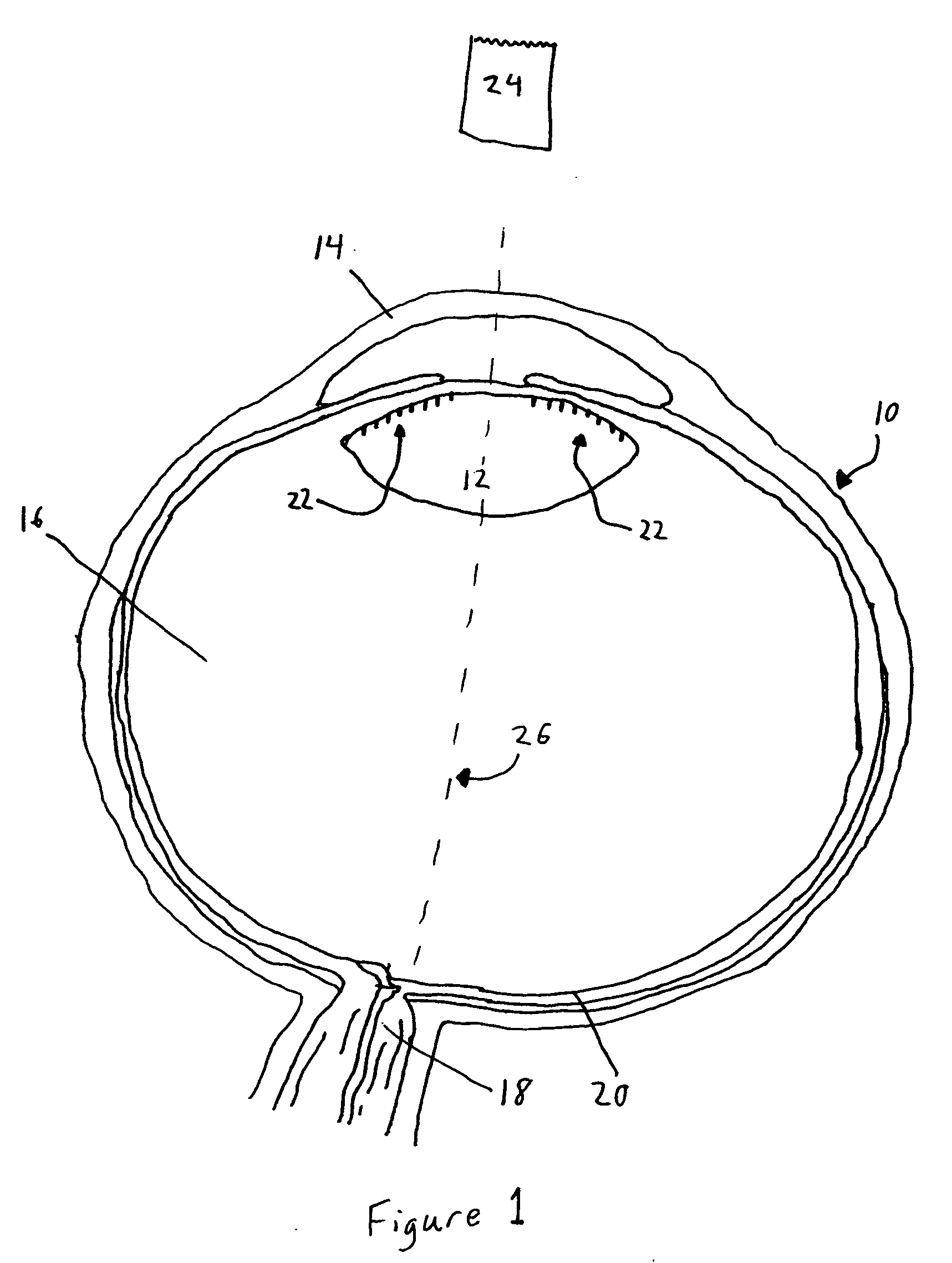 Intraocular lens adapted for adjustment via laser after implantation