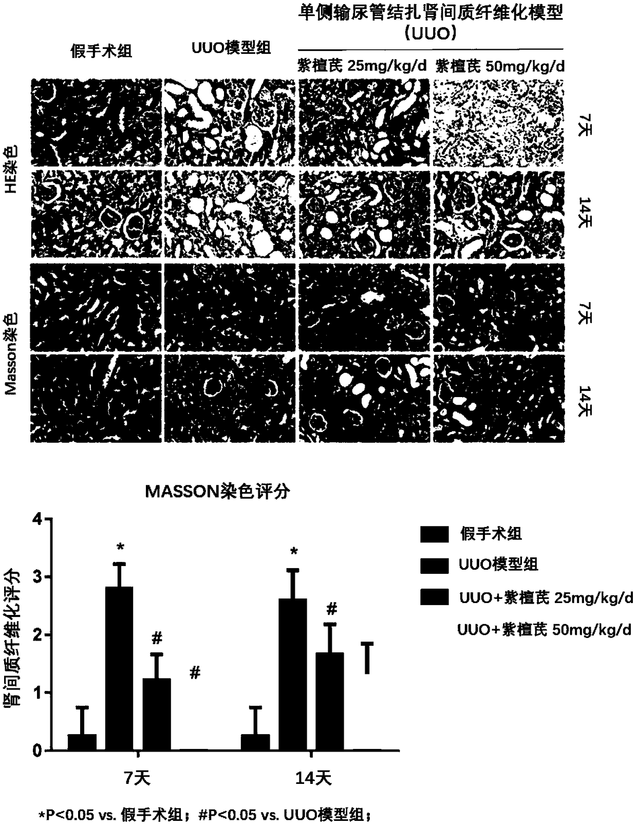 Use of pterostilbene in preparing medicine for preventing and treating high uric acid nephropathy