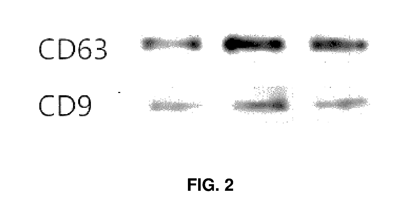 Pharmaceutical composition for treating cerebrovascular diseases, containing stem cell-derived exosome as active ingredient