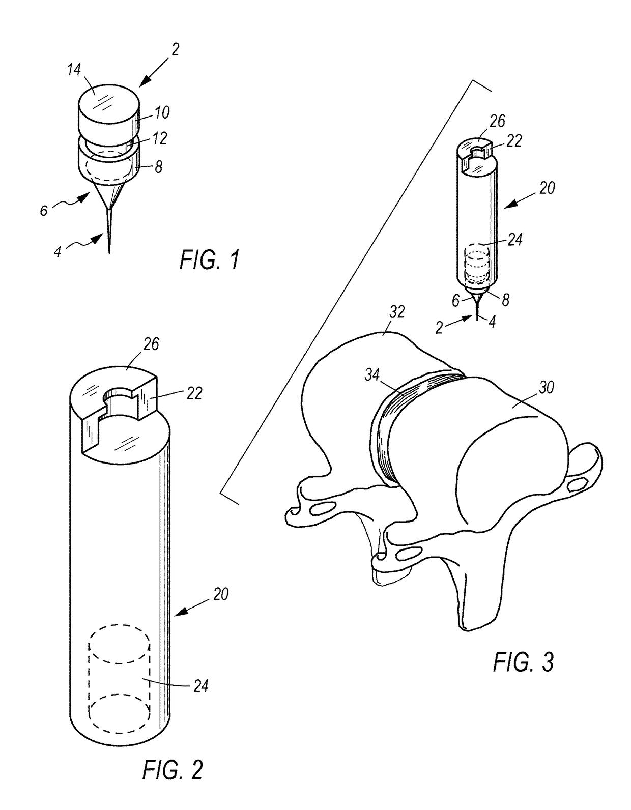 Spinal marker system and methods of use