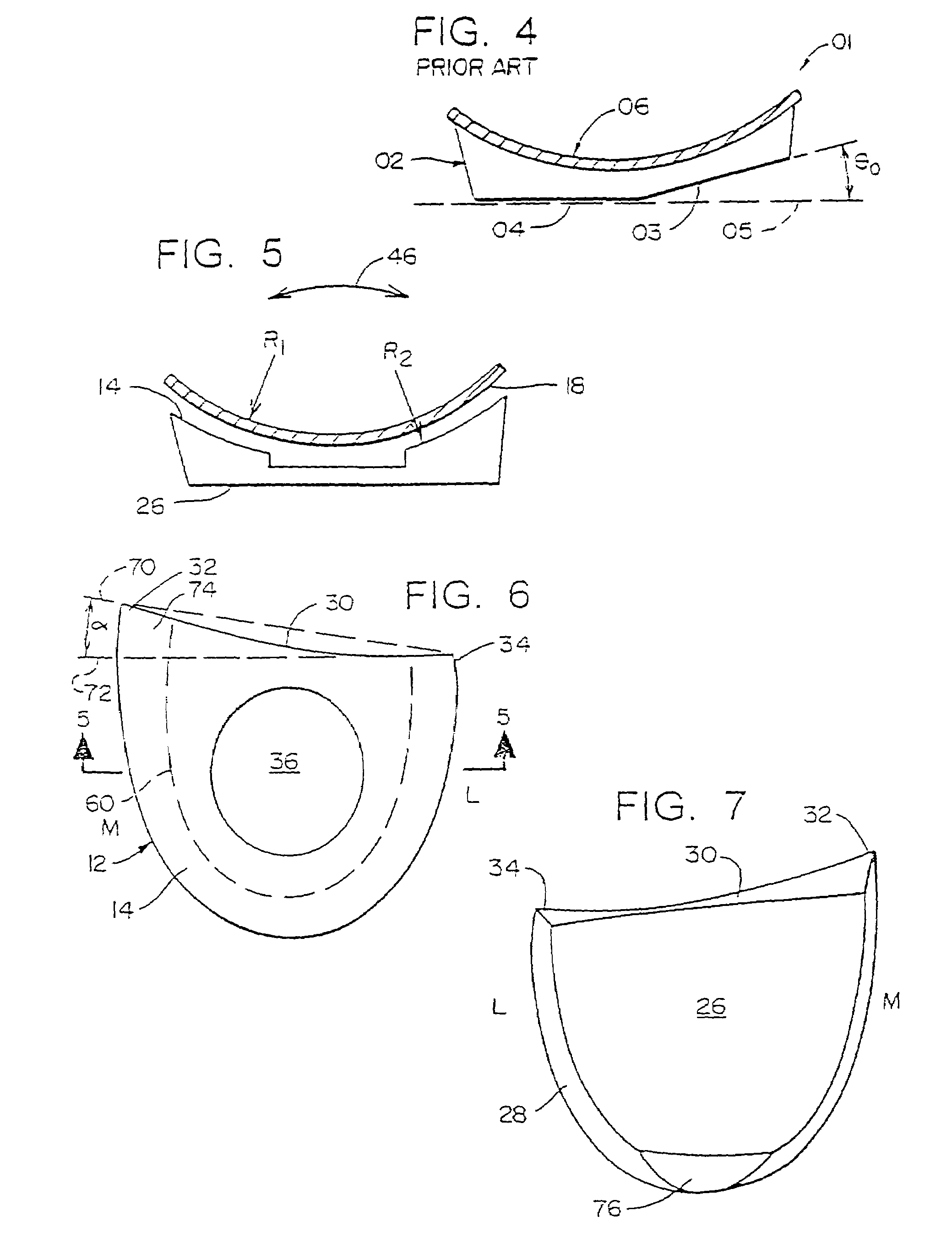 Orthotic assembly having stationary heel post and separate orthotic plate
