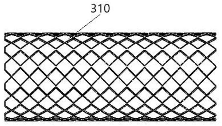 Combined artificial blood vessel and preparation method thereof