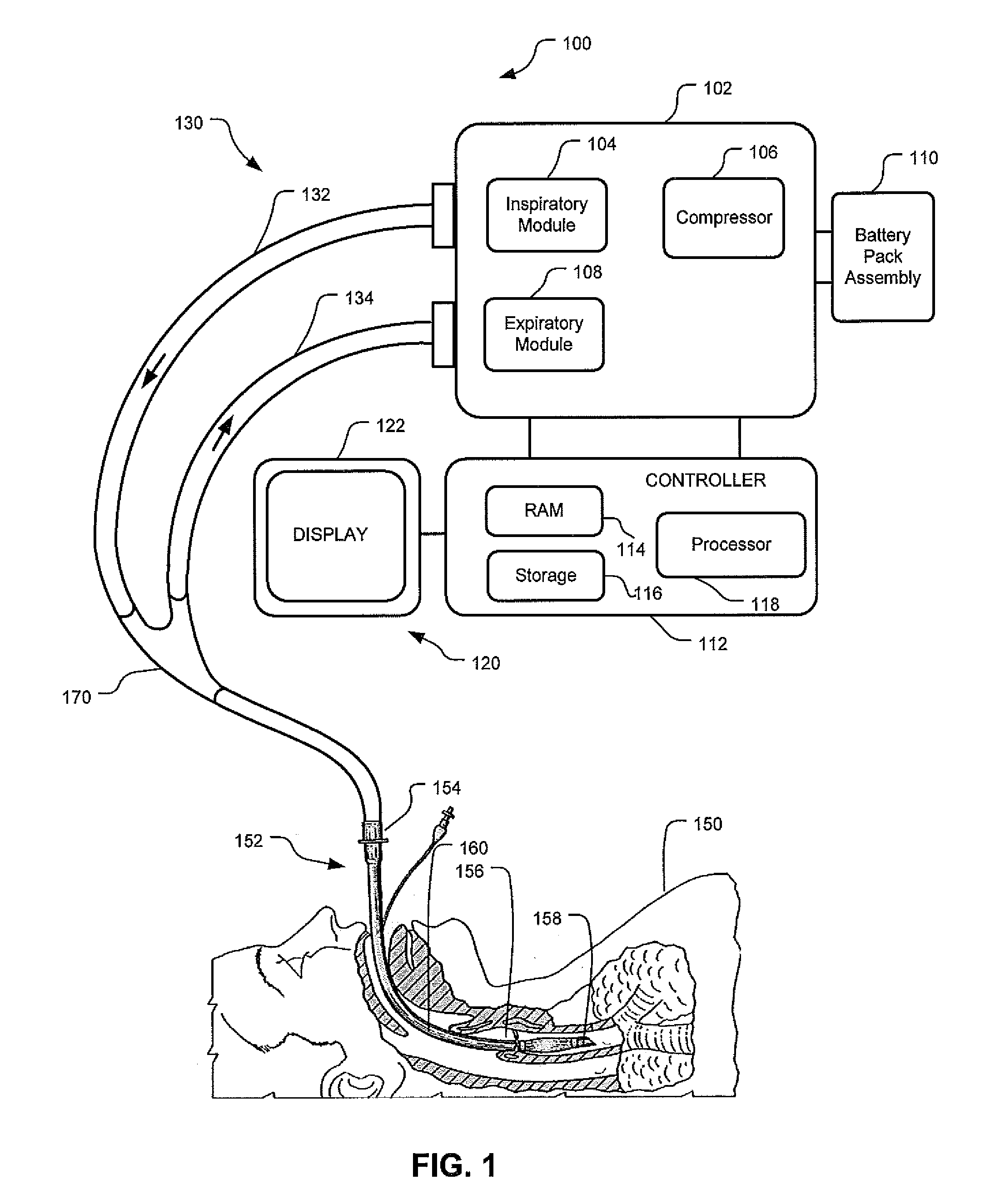 Apparatus And System For A Battery Pack Assembly Used During Mechanical Ventilation
